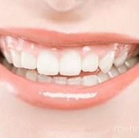 آموزش سفید کردن دندان‌