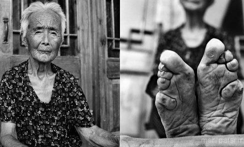 کاری وحشتناک برای زیبا کردن پاهای زنان + عکس